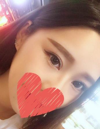 苏州省立医院整形科刘武林双眼皮好不好？真实术后照片分享