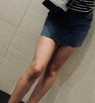 河北医科大学医院美容整形科去疤痕怎么样？要多少钱？真实案例分享