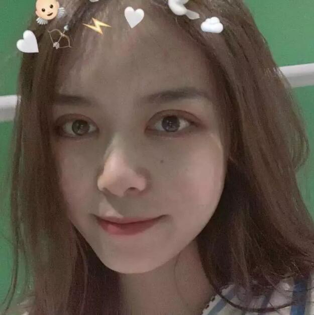 唐都医院李望舟做双眼皮怎么样？真实双眼皮案例分享