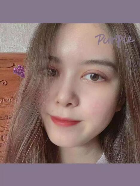 唐都医院李望舟做双眼皮怎么样？真实双眼皮案例分享