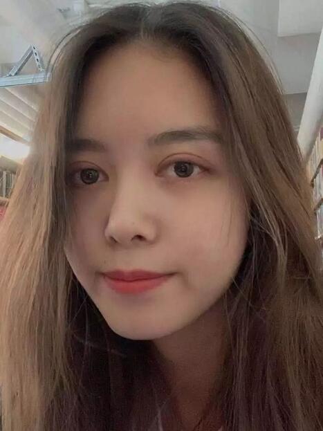 唐都医院李望舟做双眼皮怎么样？真实双眼皮案例分享