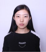 郑大一附院李广帅双眼皮真实案例分享,很自然