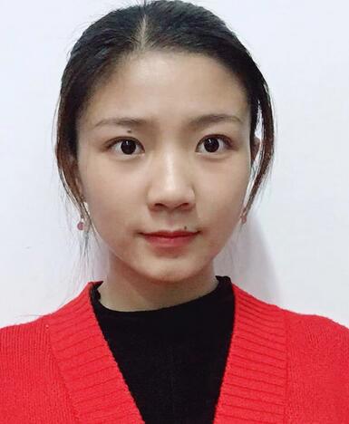 广州美莱真实隆鼻没问题分享，恢复过程
