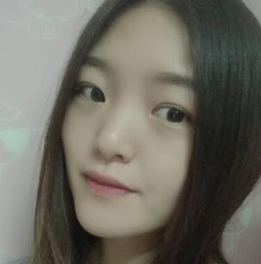 徐州美莱美容医院做双眼皮怎么样？真实案例2个月果分享