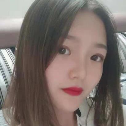 徐州美莱美容医院做双眼皮怎么样？真实案例2个月果分享