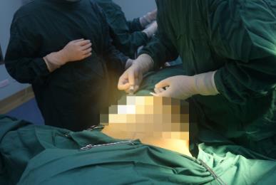 武汉五洲莱美余国胜自体脂肪丰胸真实案例分享,恢复过程,对比照