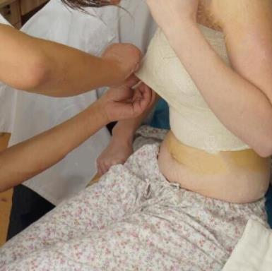 南京施尔美整形医院自体脂肪丰胸多少钱?真实丰胸经验分享