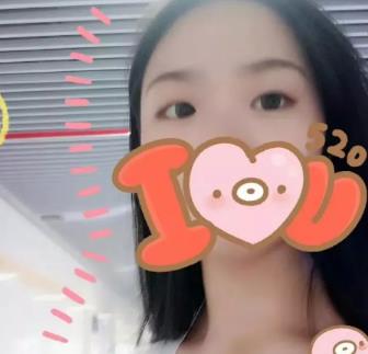 北京东方和谐做双眼皮怎么样？真人案例展示医生技术