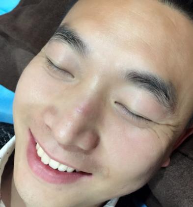 烟台毓璜顶医院整形美容科去疤痕怎么样?真人案例果分享