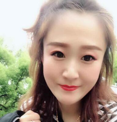 上海瑰康医疗美容医院割双眼皮果对比图，附恢复过程