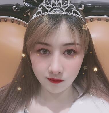 上海华美双眼皮案例果图分享,真实割双眼皮经历