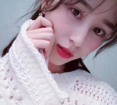 重庆西南医院王量医生双眼皮做得怎么样?真实案例反馈