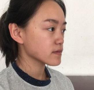 北京八大处隆鼻怎么样?我的隆鼻果较为好。