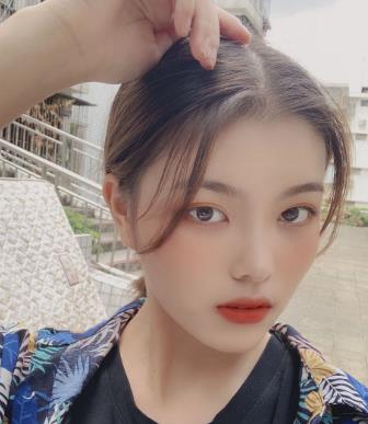 徐州市第一人民医院美容科下颌角磨骨手术果分享，丑小鸭变白天鹅~