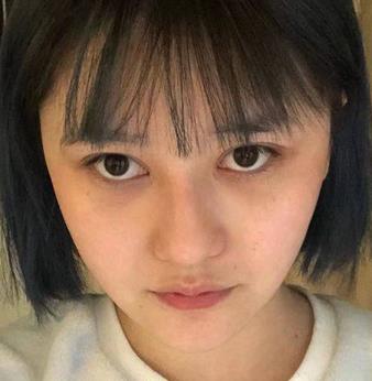 上海九院双眼皮果怎么样？真实案例展示专家实力！