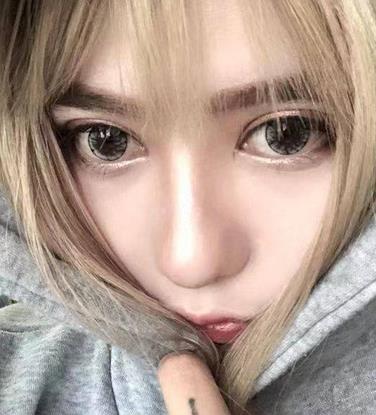上海九院双眼皮果怎么样？真实案例展示专家实力！