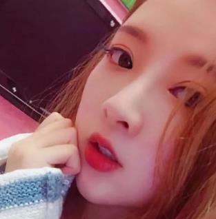 东莞市人民医院整形科割双眼皮技术怎么样?附案例一览