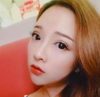 东莞市人民医院整形科割双眼皮技术怎么样?附案例一览