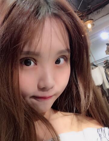 宜宾市第一人民医院整形美容外科双眼皮好不好?案例果图分享