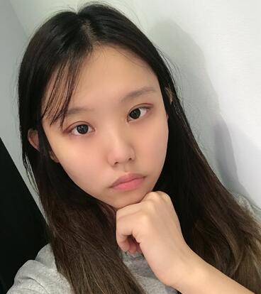 宜宾市第一人民医院整形美容外科双眼皮好不好?案例果图分享