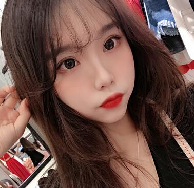 宜宾市第一人民医院整形美容外科双眼皮好不好?案例果图分享