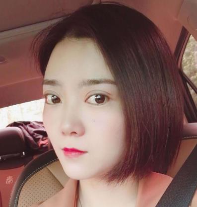深圳阳光医院双眼皮真人案例恢复过程经验分享