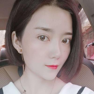 深圳阳光医院双眼皮真人案例恢复过程经验分享