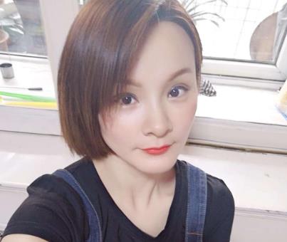 郑州人民医院整形科王剑医生双眼皮修复案例，真实双眼皮修复经验