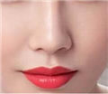 缩鼻后很自然,哈尔滨华美整形医院缩鼻翼多少钱