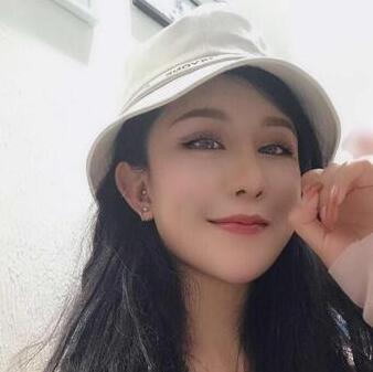 北京八大处杨明勇双眼皮案例展示，睁眼有神闭眼微创