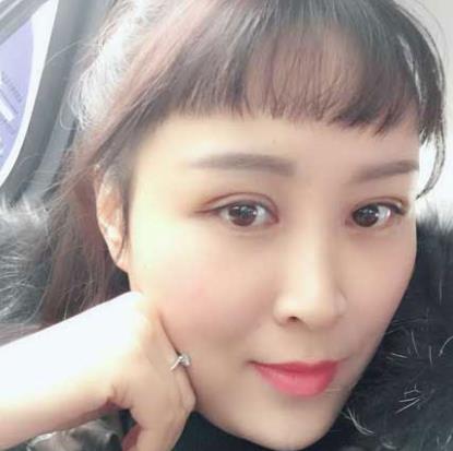 长沙安吉娜整形医院做双眼皮案例！分享做双眼皮的心理感受！