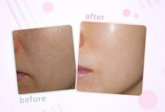 据闻：一只水光补水能抵1000张面膜？待我花100万后我觉得是真的