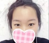 太不平衡了|姐妹的在长沙美之峰做的双眼皮为什么会这么好看，真的妒忌了