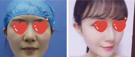 乔爱军教授的相关简介、项目价格和手术风格是什么?