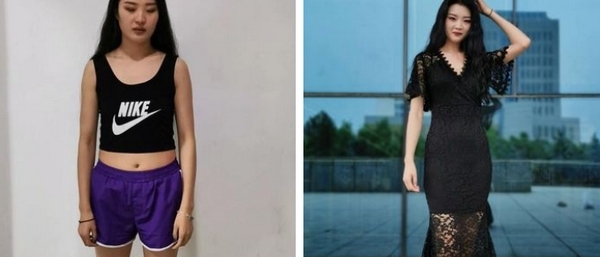 侯典举医生的吸脂技术怎么样?相关简介和项目价格是多少?