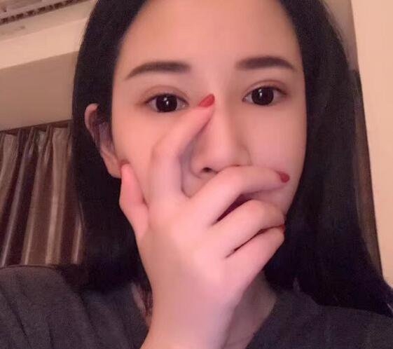 张建军医生的颌面案例好不好?价格和相关案例展示