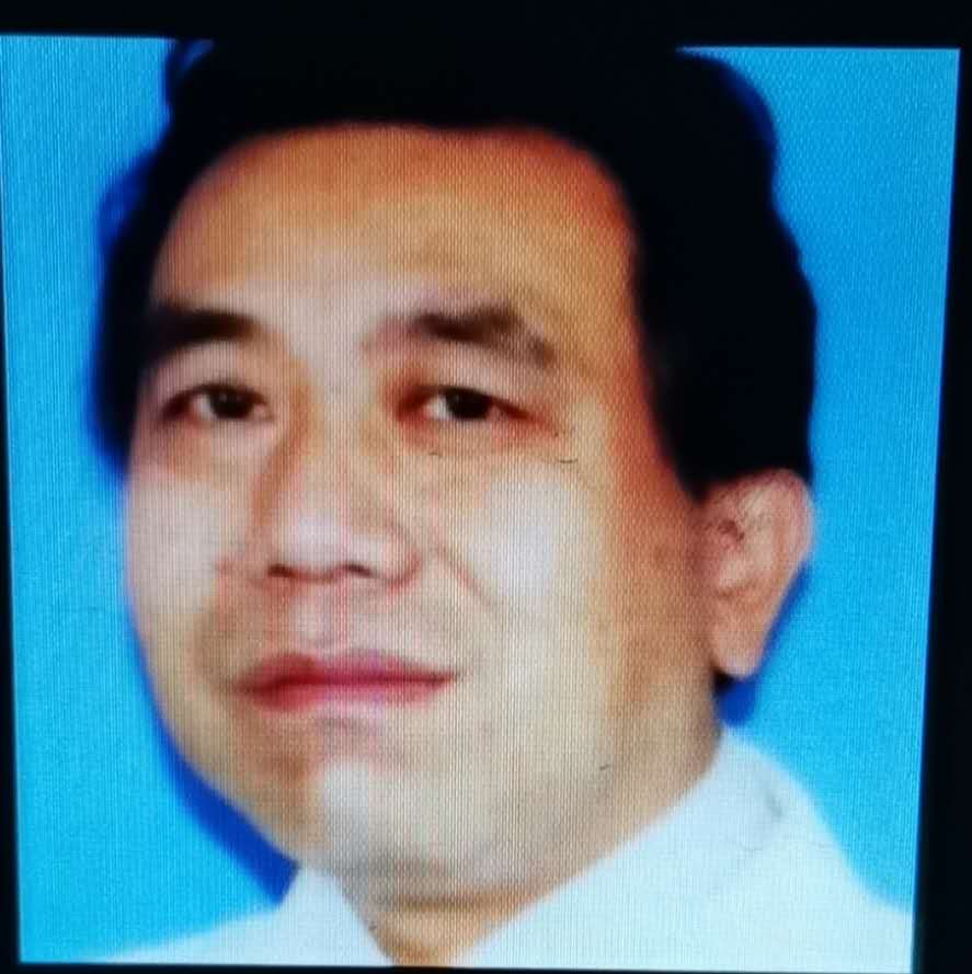 周波主任的隆胸技术怎么样?项目价格和相关案例展示