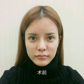 柳军医生的个人简介和擅长项目是什么?多少钱?