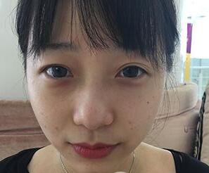 有多厉害?去找张冰洁医生做眼项目的,做完就被自己给迷住了