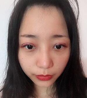 有多厉害?去找张冰洁医生做眼项目的,做完就被自己给迷住了