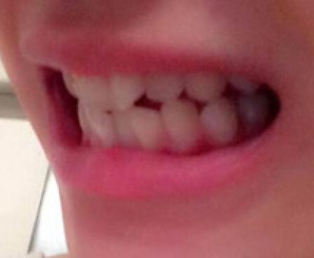 詹华医生怎么样?贵不贵?简介和案例展示