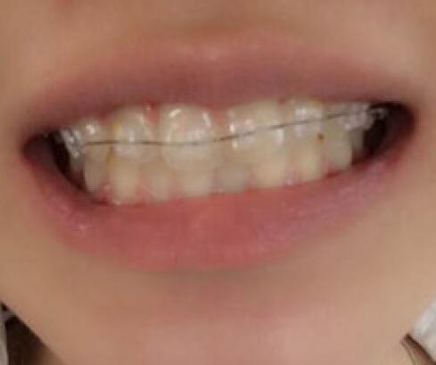 詹华医生怎么样?贵不贵?简介和案例展示