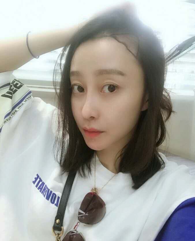 浙江王宇燕医生怎么样?贵不贵?案例和简介