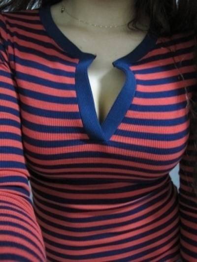 北京京美刘成胜隆胸做的怎么样？口碑和相关案例