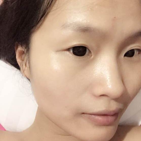 整形医生杨国梁技术怎么样？项目价格和案例分享