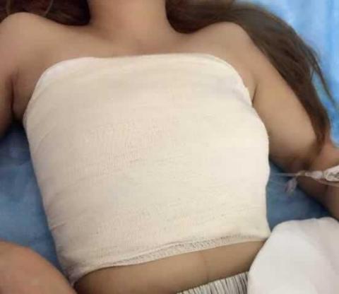 想知道|隆胸的手感和真的一样吗？会不会特别假呀