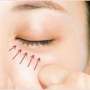 注射玻尿酸去黑眼圈的介绍、价格、优缺点和注意事项是什么?