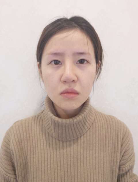 鼻修复的伤害大吗?有哪些鼻修复医生推荐?