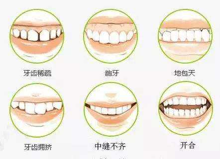 牙齿矫正需要多少时间？价格是多少呢？