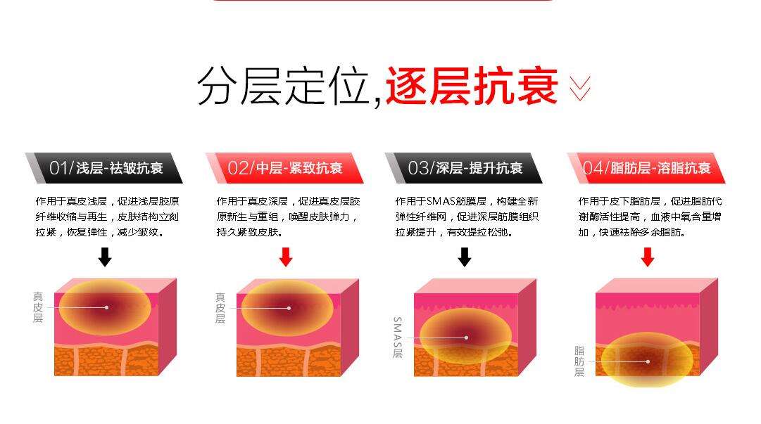 热玛吉和热拉提的区别是什么?有什么副作用吗?